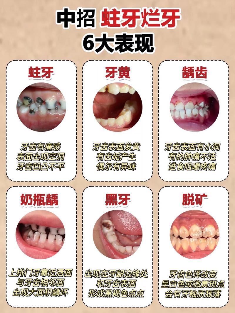 “牙膏脾气”是代表哪个生肖的简单介绍