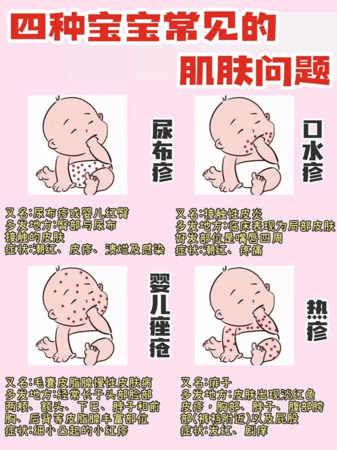 去除婴儿热疹小妙招-婴儿热疹怎么处理好得快